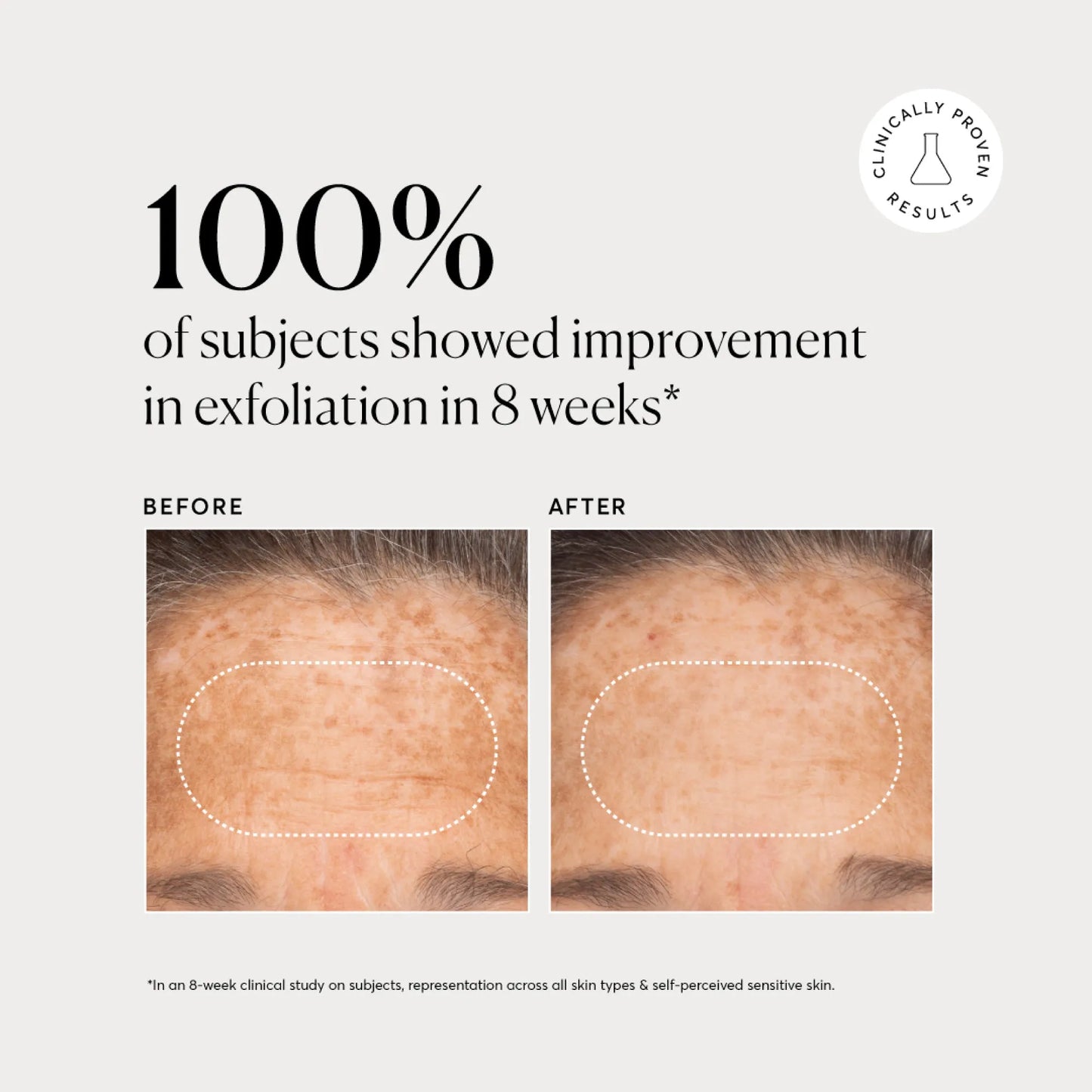 bha-liquid-exfoliant-2-h8 NATR-10027-Alt-Images-BHA-Liquid-Exfoliant-2_-03.webp